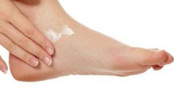 Come curare i calli: 10 rimedi naturali