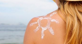 Rimedi naturali contro le scottature e le piccole ustioni