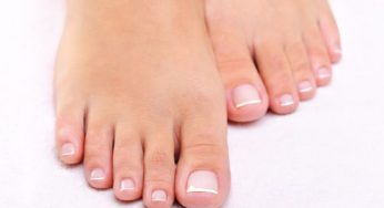 Micosi delle unghie: rimedi naturali
