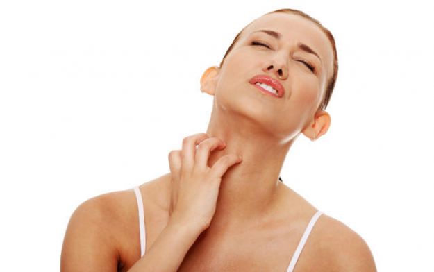 Young beautiful woman scratching her self. rimedi naturali orticaria