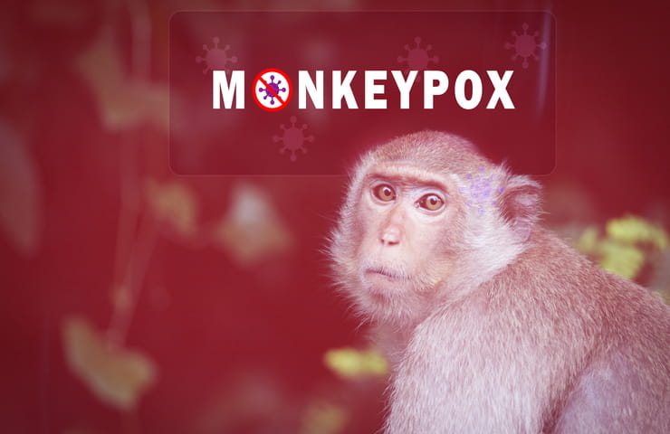 Vaiolo delle scimmie (Foto Adobe)