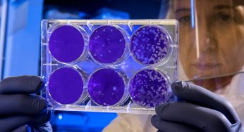 Rinvenuti batteri che digeriscono il glutine, un futuro senza allergie?