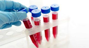 Dove viene buttato il sangue dopo le analisi? La risposta che ti stupirà