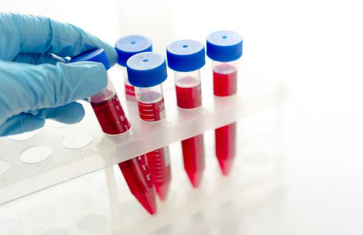 Blood analysis as disposed