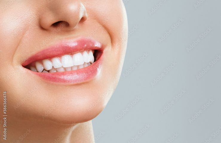 denti bianchi donna