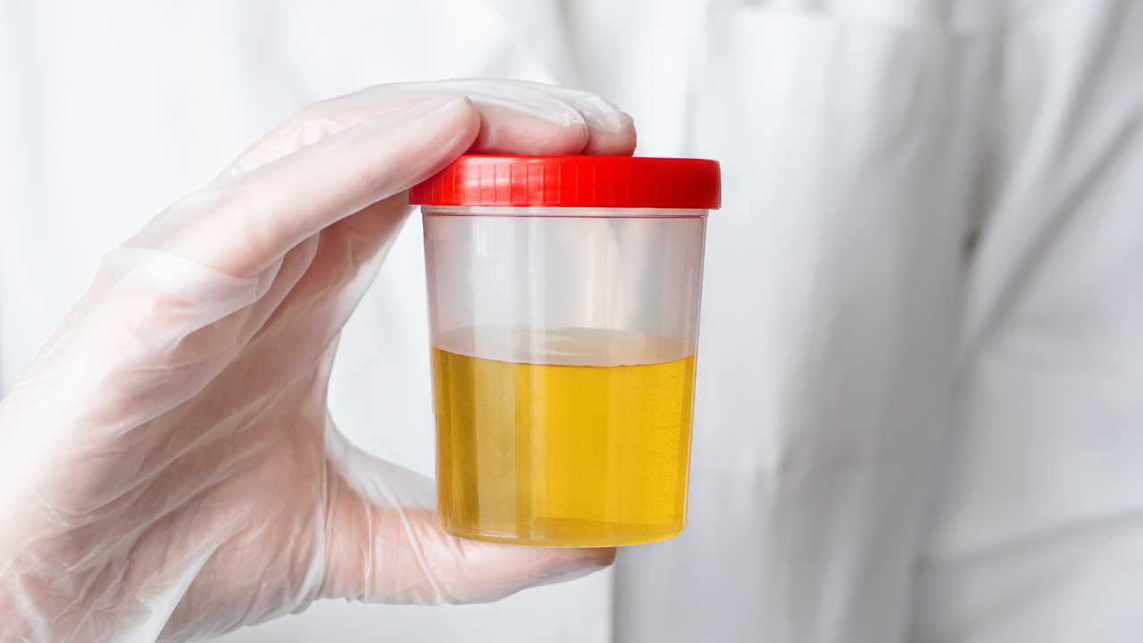 analisi urine importante