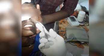 Bambino dolorante viene portato dal medico: dopo pochi minuti gli estraggono questo dal naso