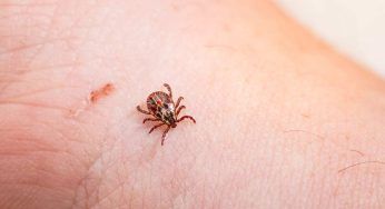 A soli 4 anni la corsa in ospedale: punta da una zecca contrae la malattia di Lyme