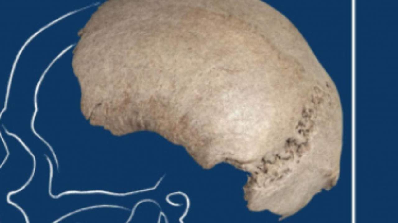 homo sapiens osso occipitale e parietale