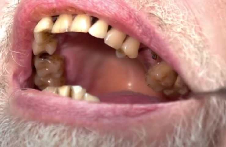 La storia incredibile di un uomo con un gran male ai denti