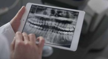 Va dal medico con un dolore lancinante ai denti: sconvolgente la causa