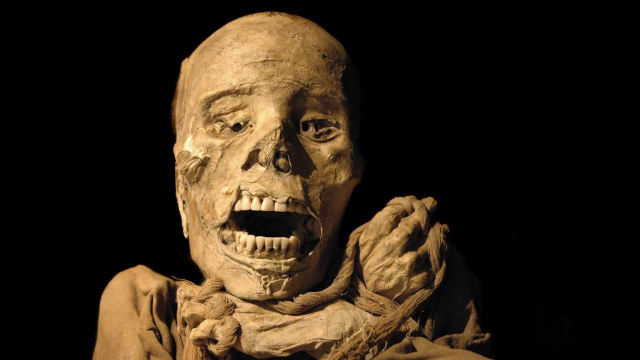 Infezione fungo Coccidioides morte mummia ragazza Bolivia