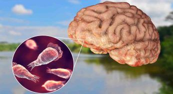 Morto dopo una nuotata, l’ameba mangia cervello uccide ancora